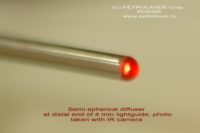 Рекс - Лазерный терапевтический комплекс